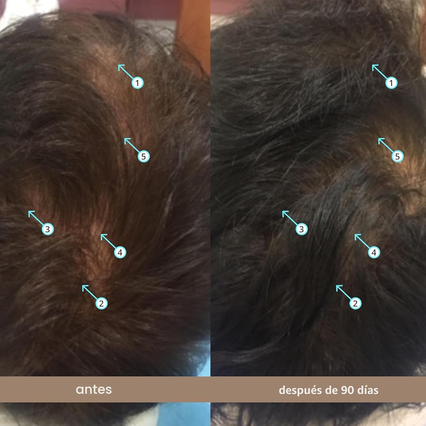 Elixia® Suero Anticaída Secado Invisible