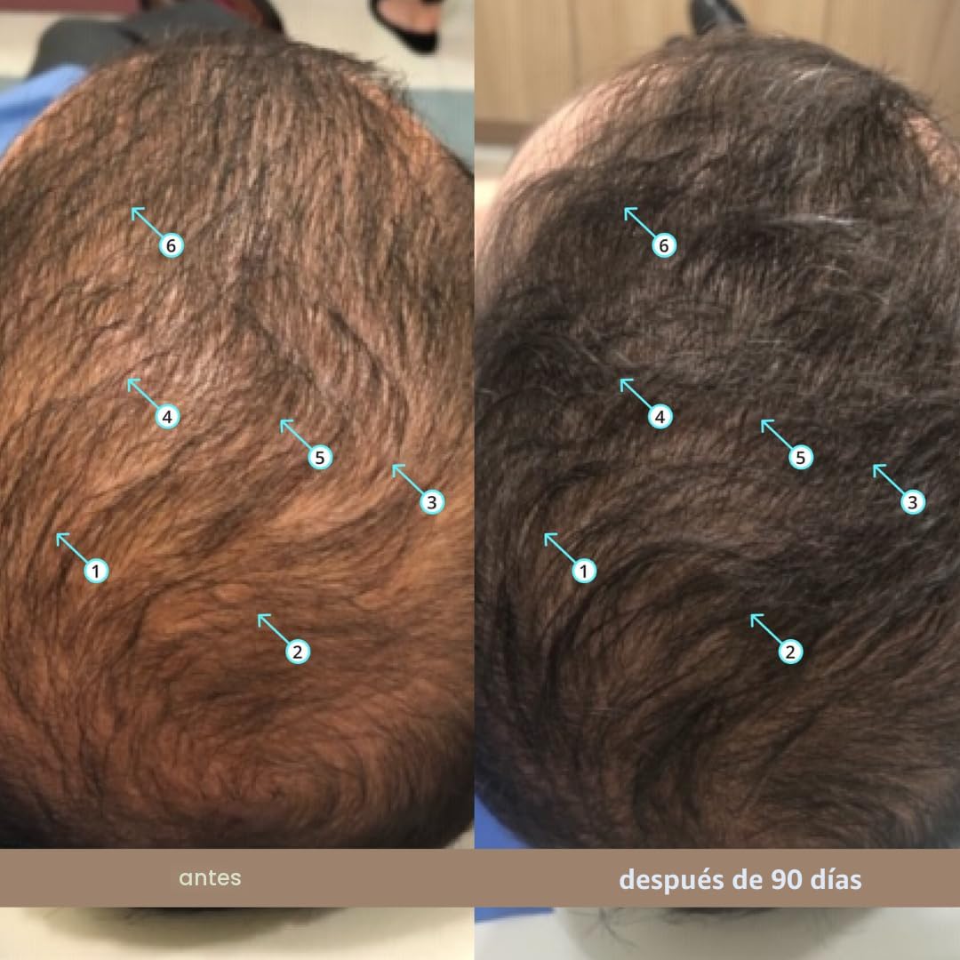 Elixia® Suero Anticaída Secado Invisible
